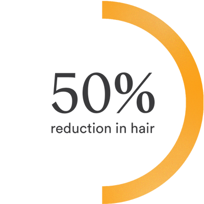 50% hair reduction chart