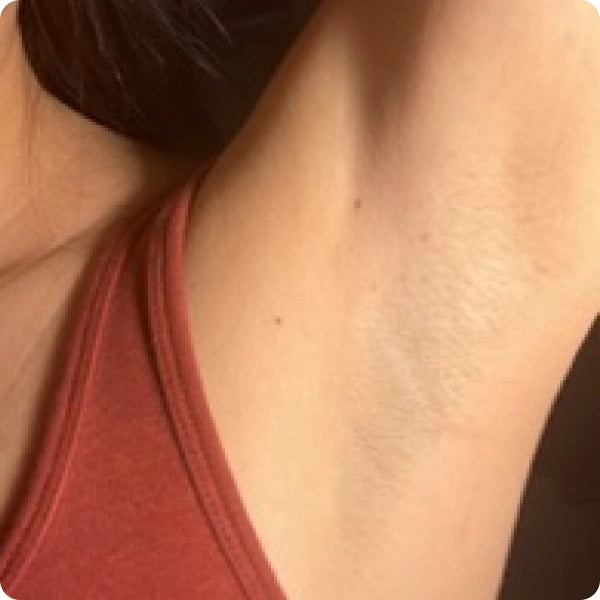 Woman showing smooth armpit after 4+ weeks of use