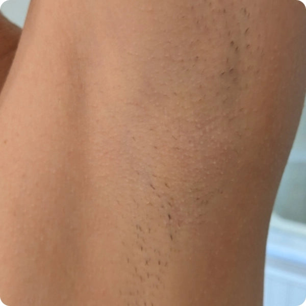 Woman showing armpit after 2-3 weeks of use