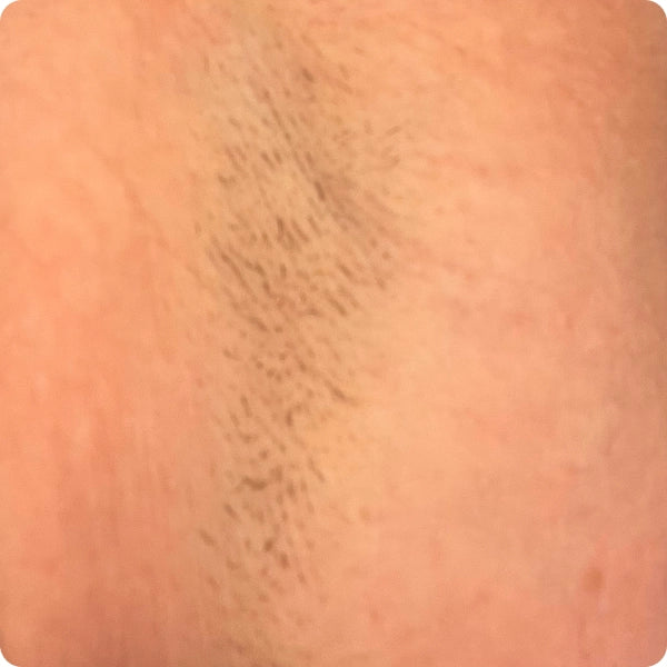 Woman showing armpit after 1-2 weeks of use
