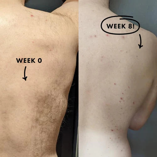 The Noodist Kit – nood