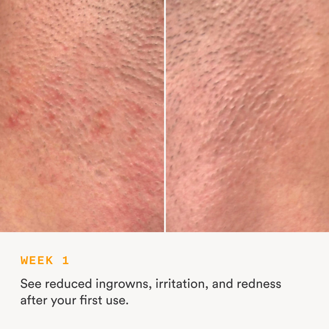The Nood Serum
