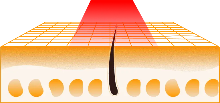Red Light Therapy